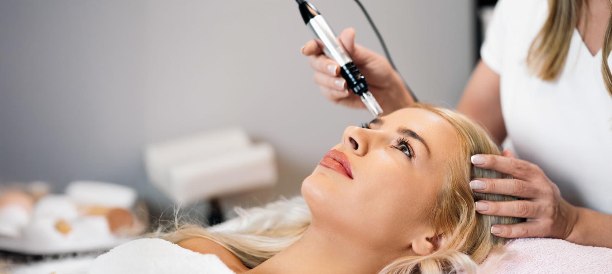 Microneedling St.Gallen